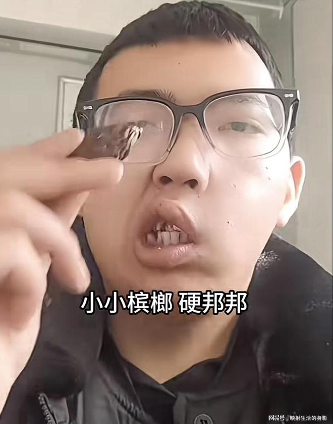 导致脸部变形还边嚼边劝大家别碰槟榔long88龙8国际男子嚼槟榔七年(图2)